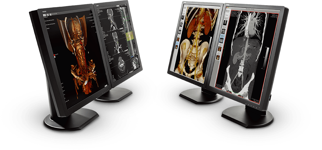 Diagnostic Displays | MEDUTECH s.r.o.